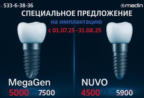 Специальное предложение на имплантацию зубов с 01.07.20-31.08.25