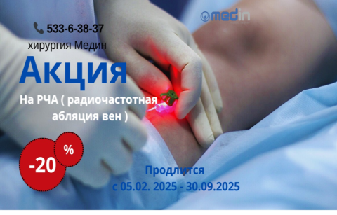 Акция на РЧА радиочастотная абляция вен